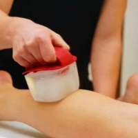 Krioterapia Miejscowa/Masaż Lodem 30min.